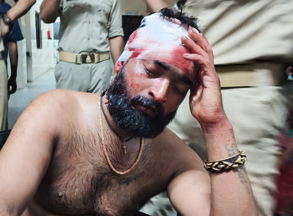 गोली लगने से घायल सोनम किन्नर। संवाद गोली लगने से घायल सोनम किन्नर। संवाद