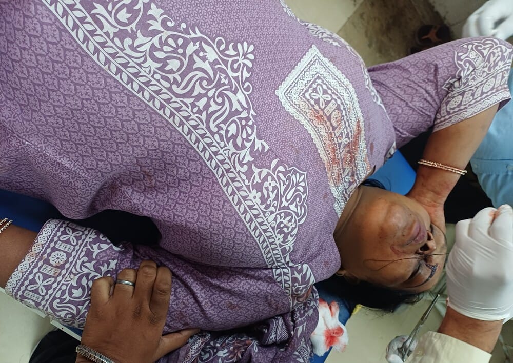 छावनी के नागरिक अस्पताल में उपचाराधीन रजनीश कुमार। संवाद