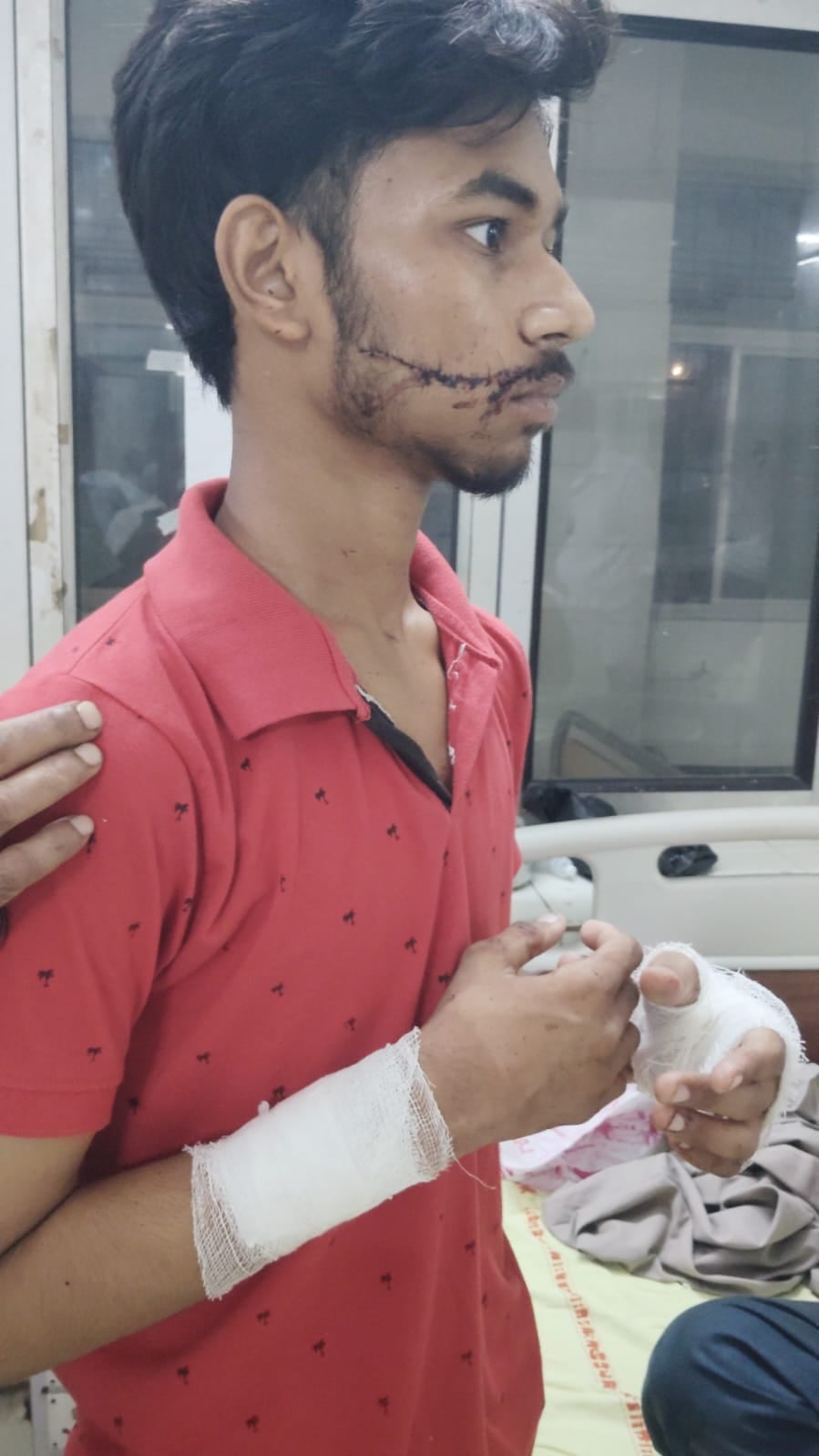 नैनी। घायल राकेश पाल नैनी। घायल राकेश पाल