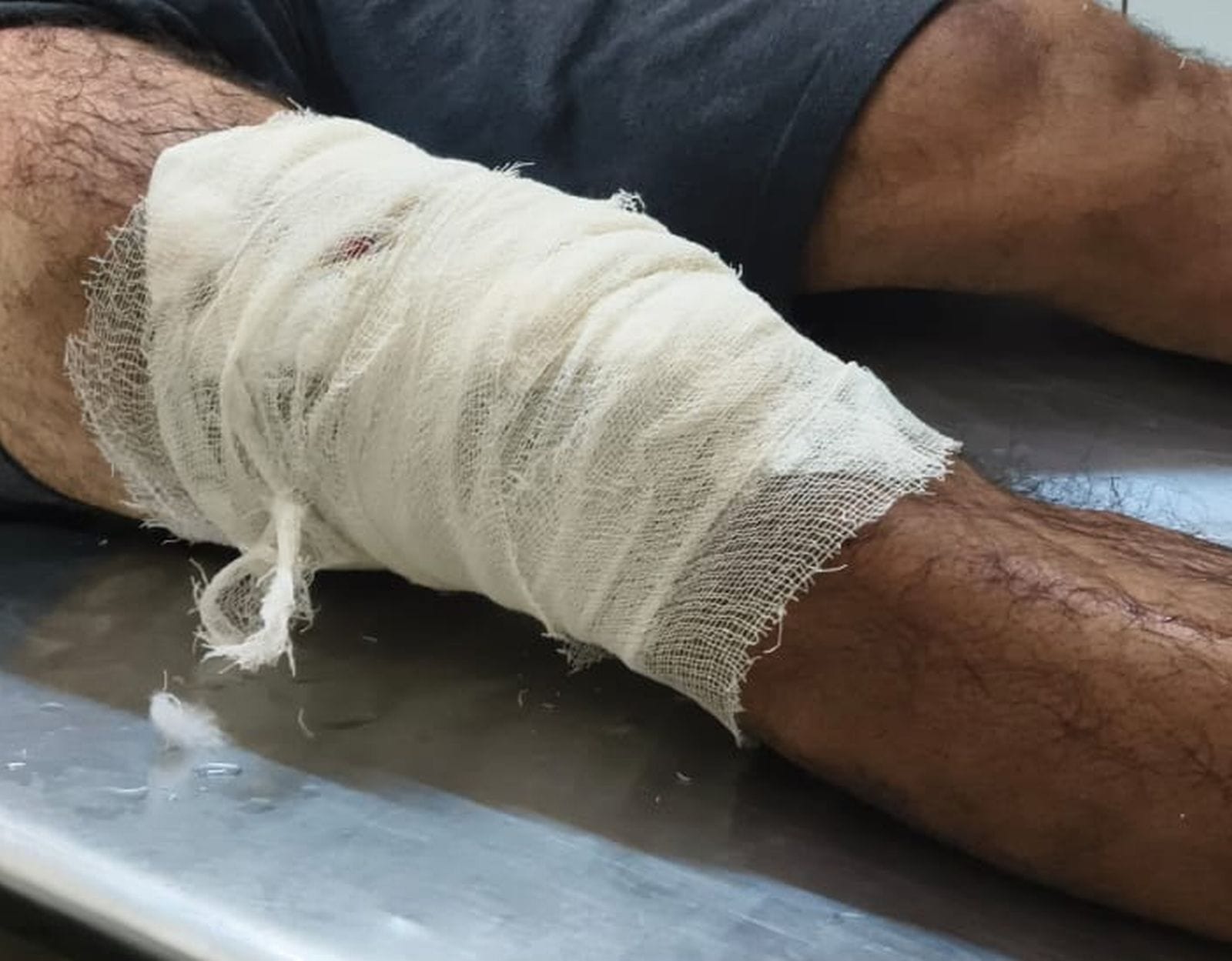 घटना के बाद सामुदायिक स्वास्थ्य केंद्र मेें घायल की जानकारी करते सीओ बिसौली अंशुमन श्रीवास्तव।