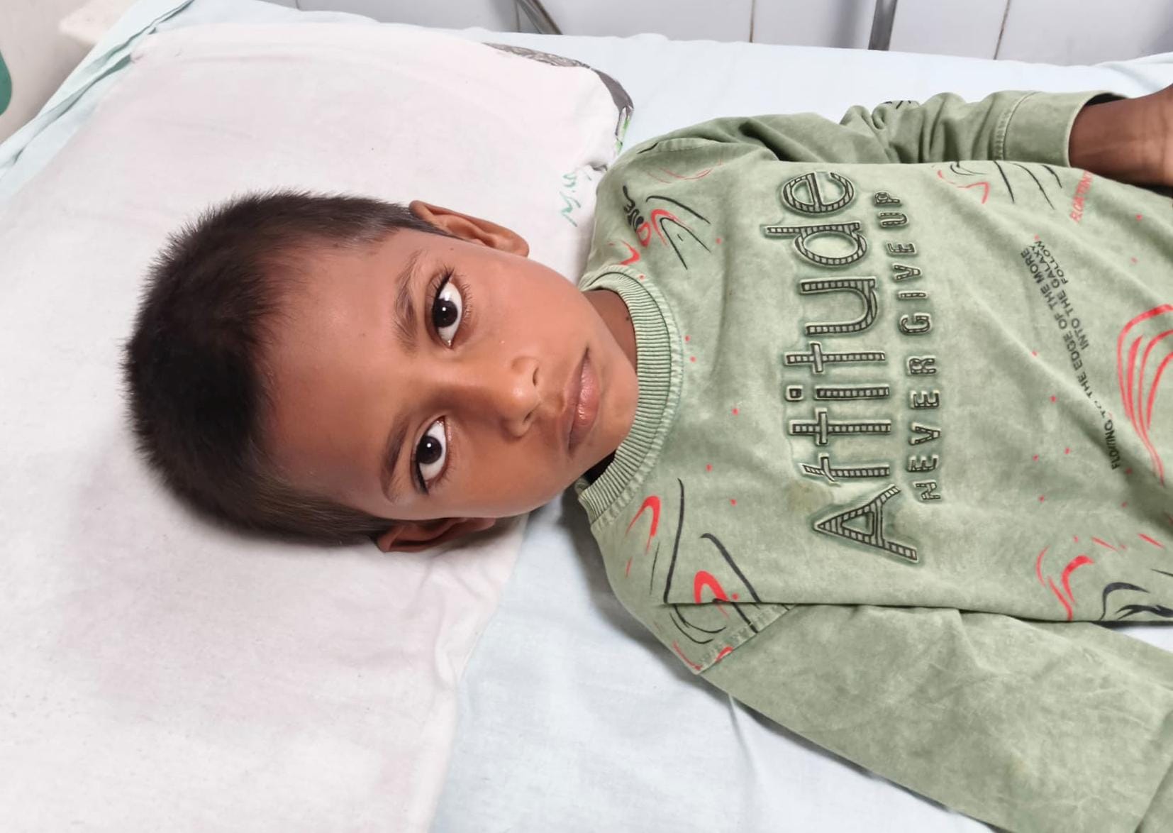कुत्ते के हमले में घायल बच्चे। कुत्ते के हमले में घायल बच्चे।