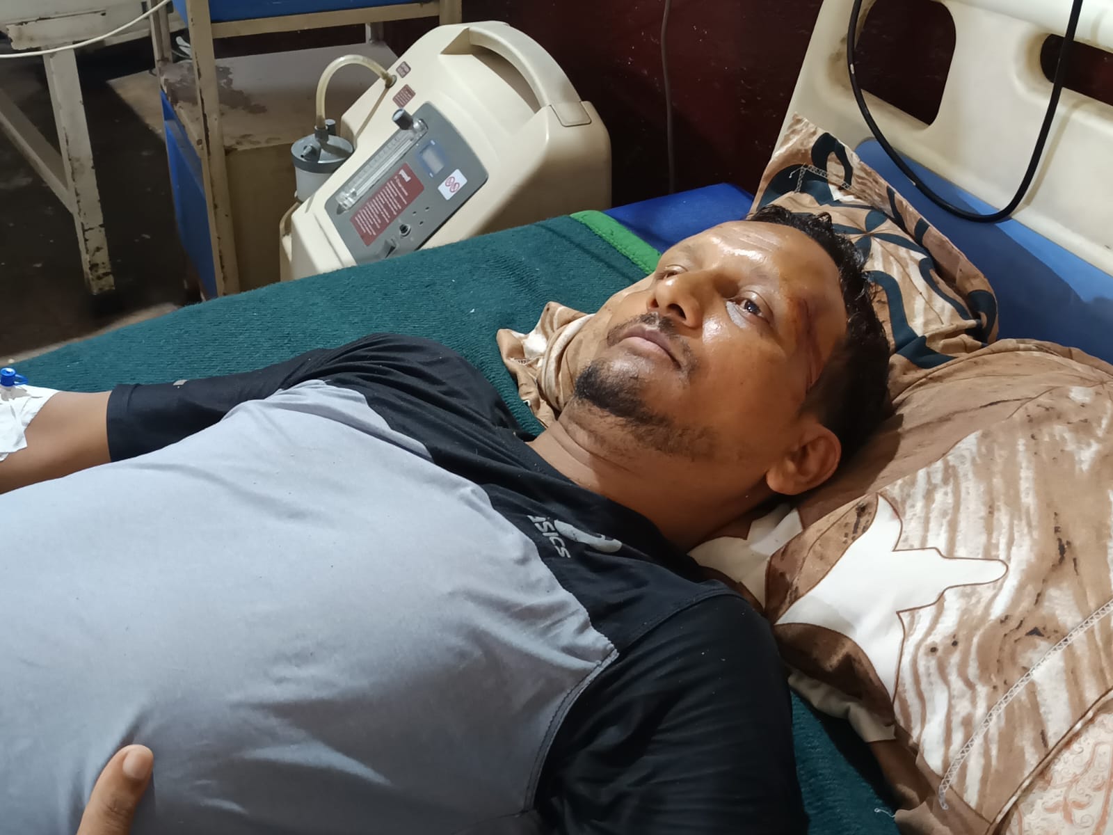आसमानी बिजली से जख्मी हुआ विकास