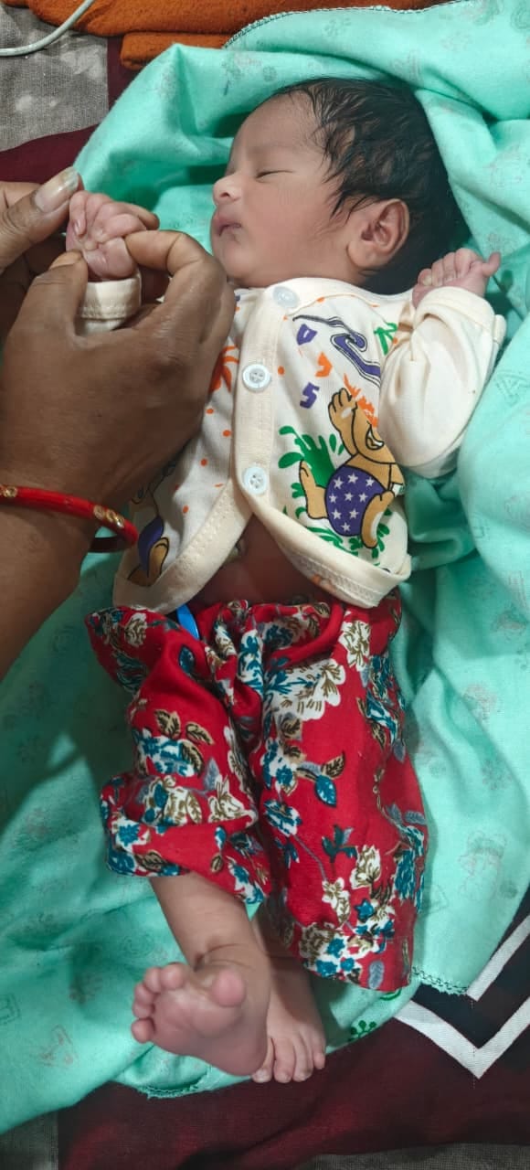 पालमपुर अस्पताल में हाथ और पैरों की छह-छह उंगलियों वाली बच्ची। -स्रोत ः स्वास्थ्य विभाग पालमपुर अस्पताल में हाथ और पैरों की छह-छह उंगलियों वाली बच्ची। -स्रोत ः स्वास्थ्य विभाग