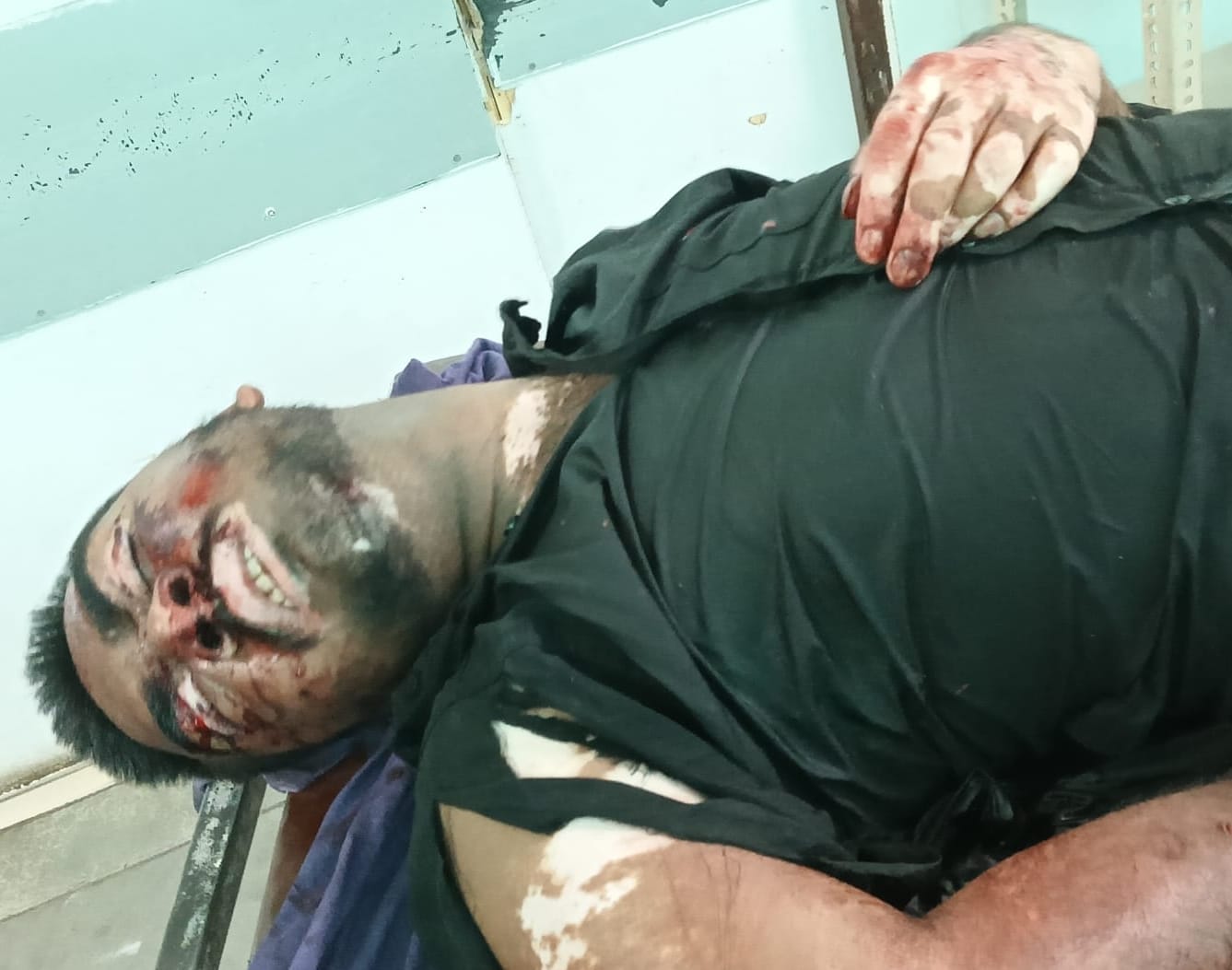 42-आईएमटी स्थित नौनंद रोड पर हादसे के बाद जांच करती पुलिस। स्रोत : परिजन