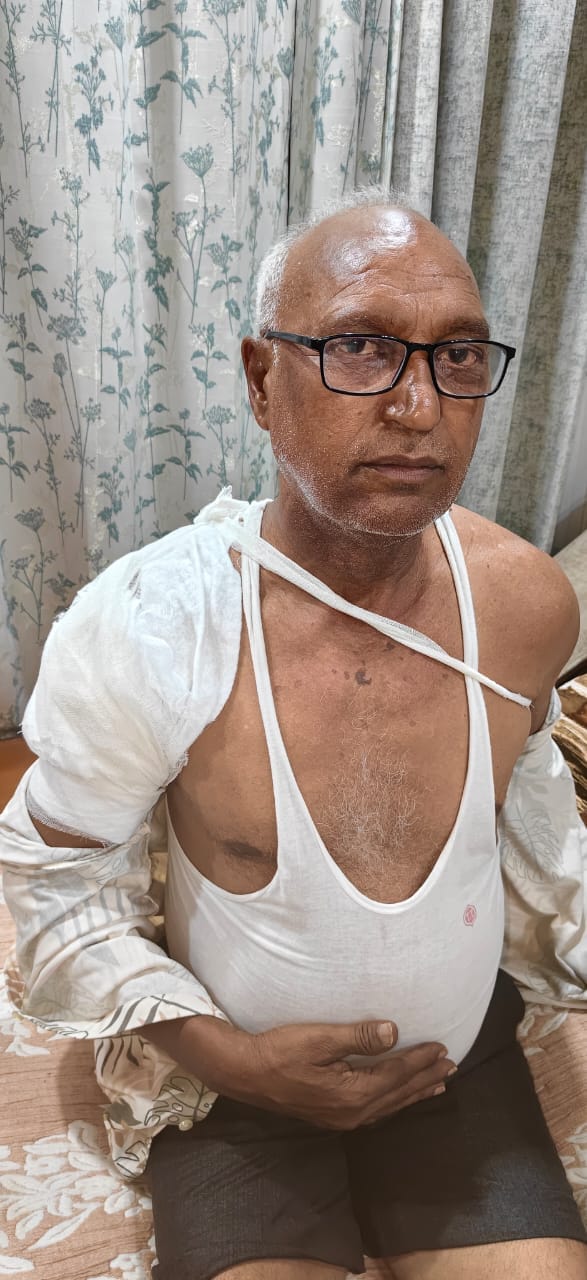 नोएडा जेपी कॉसमॉस सोसायटी में गिर रहा प्लास्टर। नोएडा जेपी कॉसमॉस सोसायटी में गिर रहा प्लास्टर।