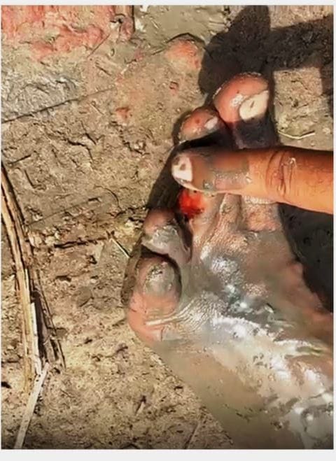 फोटो : सोनीपत के गांव बेगा में खेत में भिरड़ों के हमले के दौरान दौड़ते पटवारी। स्रोत: वीडियो ग् फोटो : सोनीपत के गांव बेगा में खेत में भिरड़ों के हमले के दौरान दौड़ते पटवारी। स्रोत: वीडियो ग्