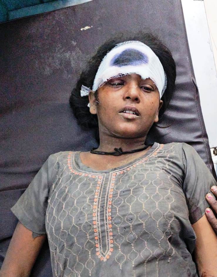 सरधना। गांव कुशावली में मकान की छत गिरने से घायलों को सीएचसी लेकर पहुंची ऐंबुलेंस। संवाद सरधना। गांव कुशावली में मकान की छत गिरने से घायलों को सीएचसी लेकर पहुंची ऐंबुलेंस। संवाद