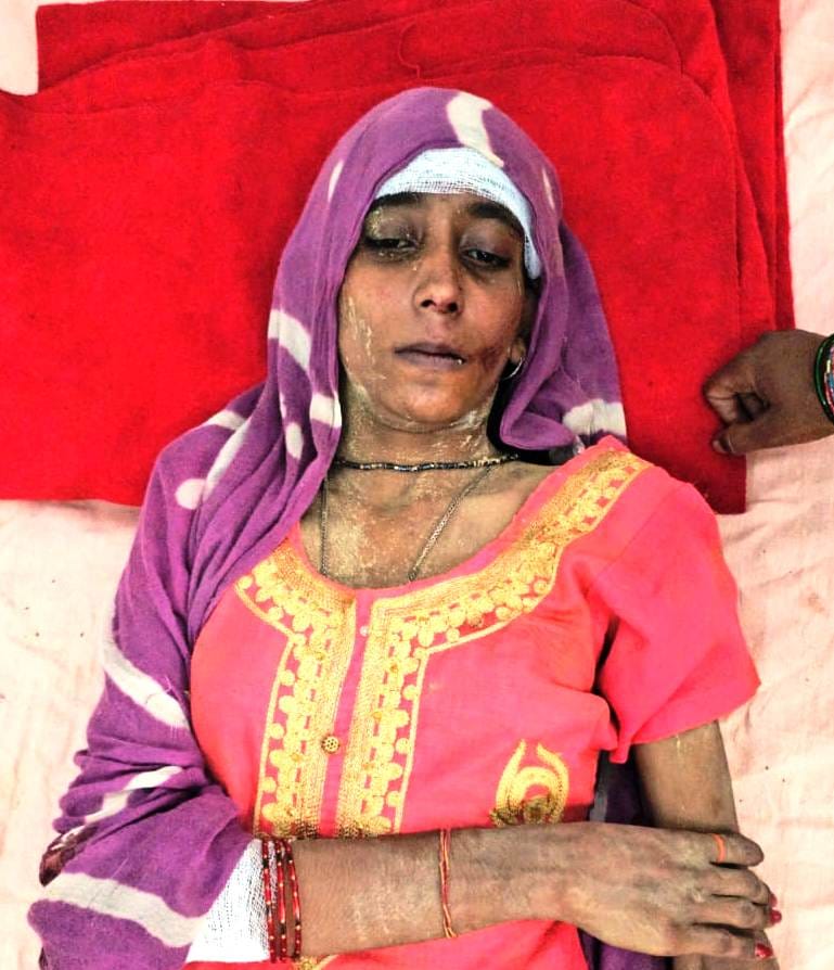 सरधना। गांव कुशावली में मकान की छत गिरने से घायलों को सीएचसी लेकर पहुंची ऐंबुलेंस। संवाद सरधना। गांव कुशावली में मकान की छत गिरने से घायलों को सीएचसी लेकर पहुंची ऐंबुलेंस। संवाद