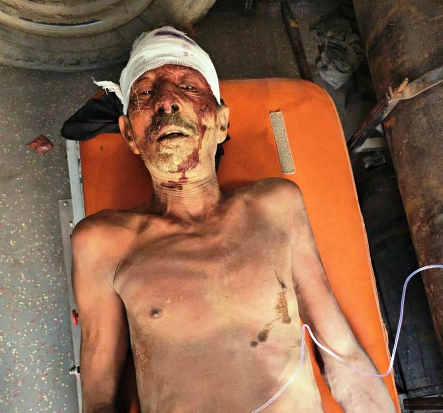 सरधना। गांव कुशावली में मकान की छत गिरने से घायलों को सीएचसी लेकर पहुंची ऐंबुलेंस। संवाद सरधना। गांव कुशावली में मकान की छत गिरने से घायलों को सीएचसी लेकर पहुंची ऐंबुलेंस। संवाद
