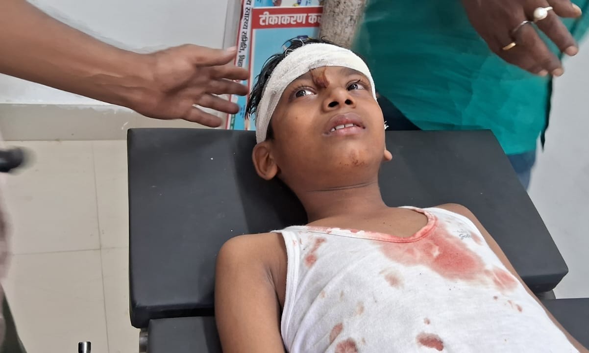 इलाजरत घायल बच्चे व दुर्घटनाग्रस्त टेंपो इलाजरत घायल बच्चे व दुर्घटनाग्रस्त टेंपो