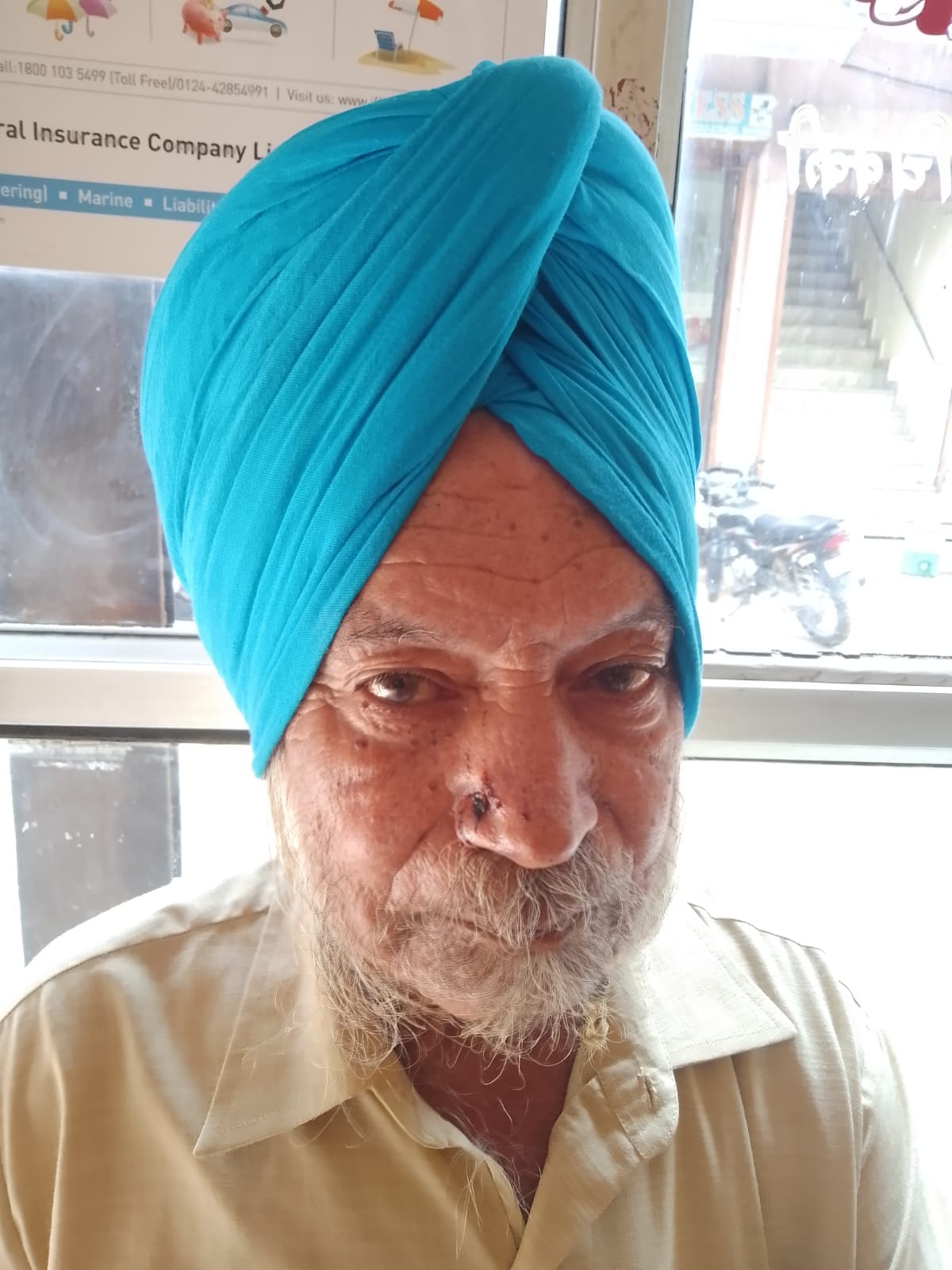 फोटो नंबर- 13 कुत्तों के काटने से संतोख सिंह के हाथ पर आई सूजन व निशान। संवाद फोटो नंबर- 13 कुत्तों के काटने से संतोख सिंह के हाथ पर आई सूजन व निशान। संवाद