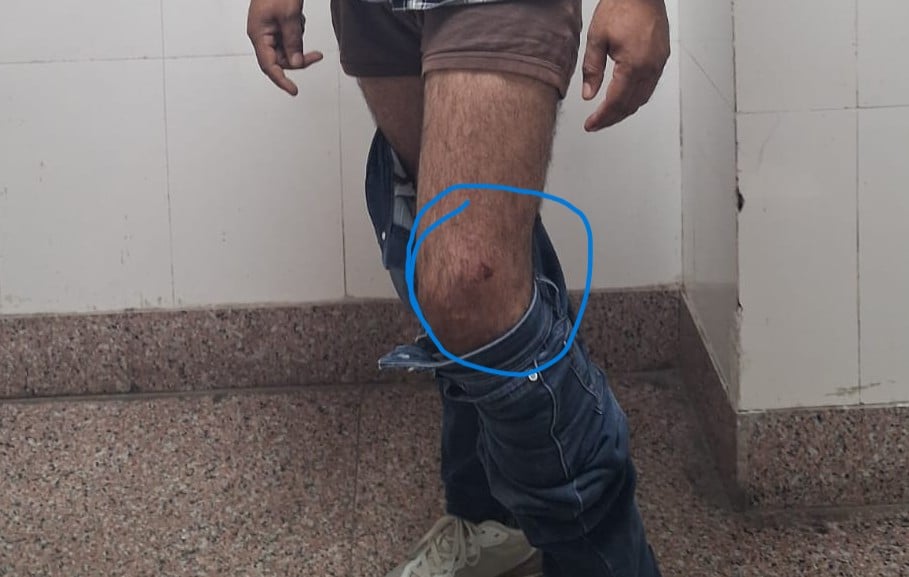 गली में पिटबुल कुत्ते को लेकर जाता आरोपी। सीसीटीवी गली में पिटबुल कुत्ते को लेकर जाता आरोपी। सीसीटीवी