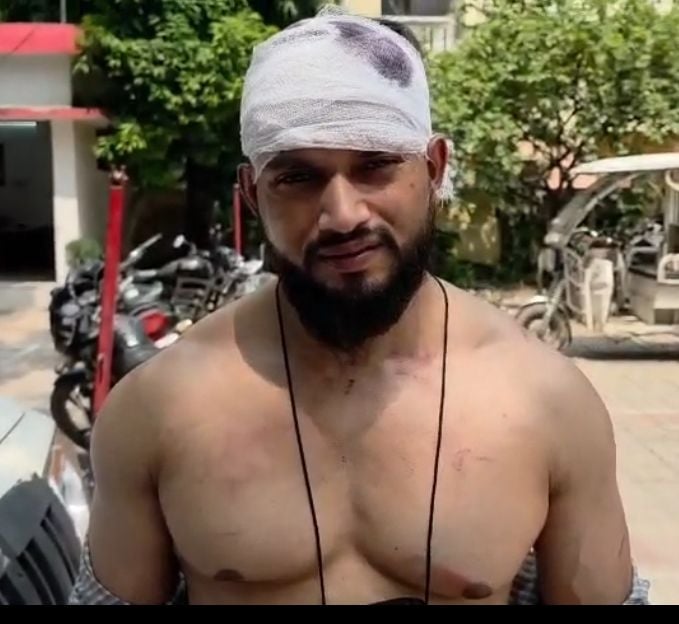 पिटाई से घायल नीरज मौर्या। पिटाई से घायल नीरज मौर्या।