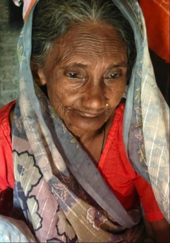 बंदर के हमले में घायल अनौनी गांव निवासी श्यामदेई। संवाद बंदर के हमले में घायल अनौनी गांव निवासी श्यामदेई। संवाद
