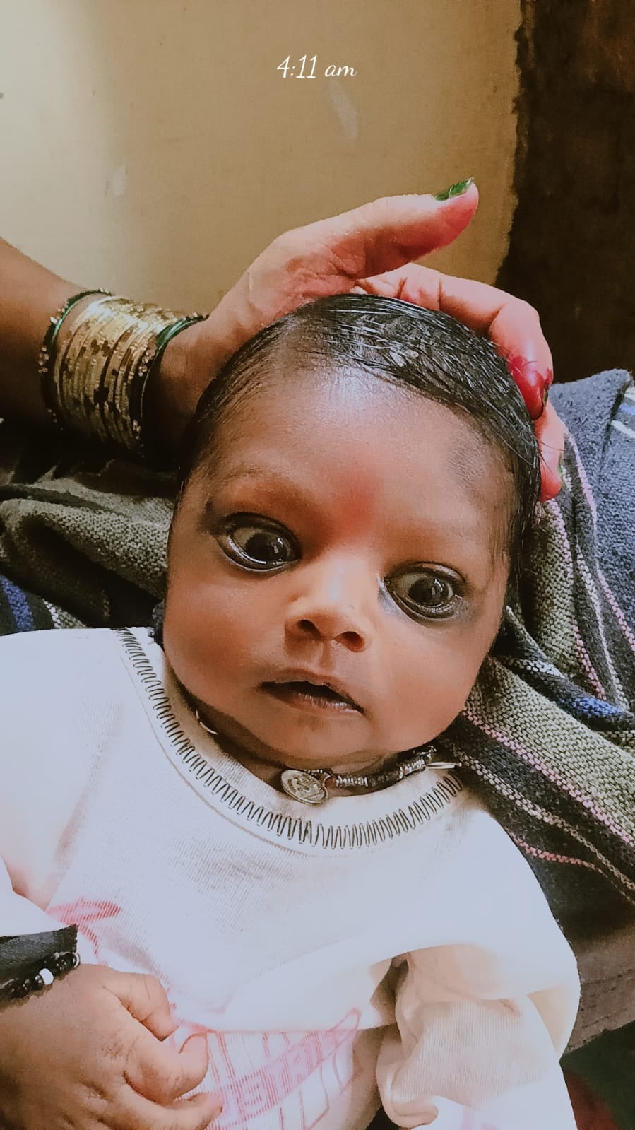 फोटो 25 एचएएमपी 25- ओपीडी पर्चा। फोटो 25 एचएएमपी 25- ओपीडी पर्चा।