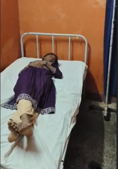 28 सीकेटीपी 27 आग से जला सामान।