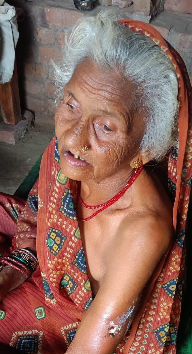 फोटो-16- कुत्ते के हमले से घायल अर्चना पटेल। स्रोत ग्रामीण