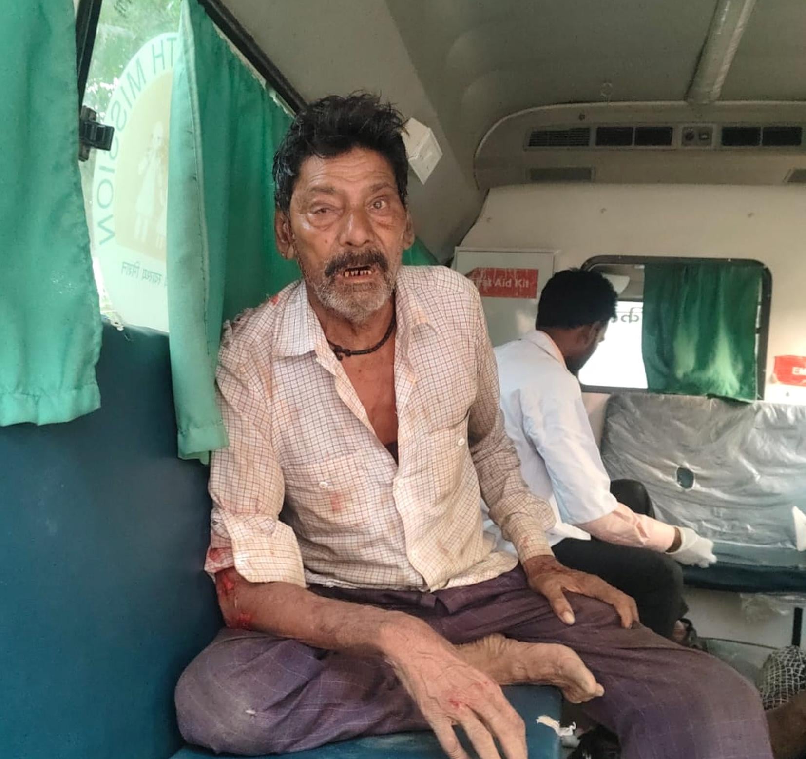 जंगली जानवर के हमले में घायल हुए लोग।