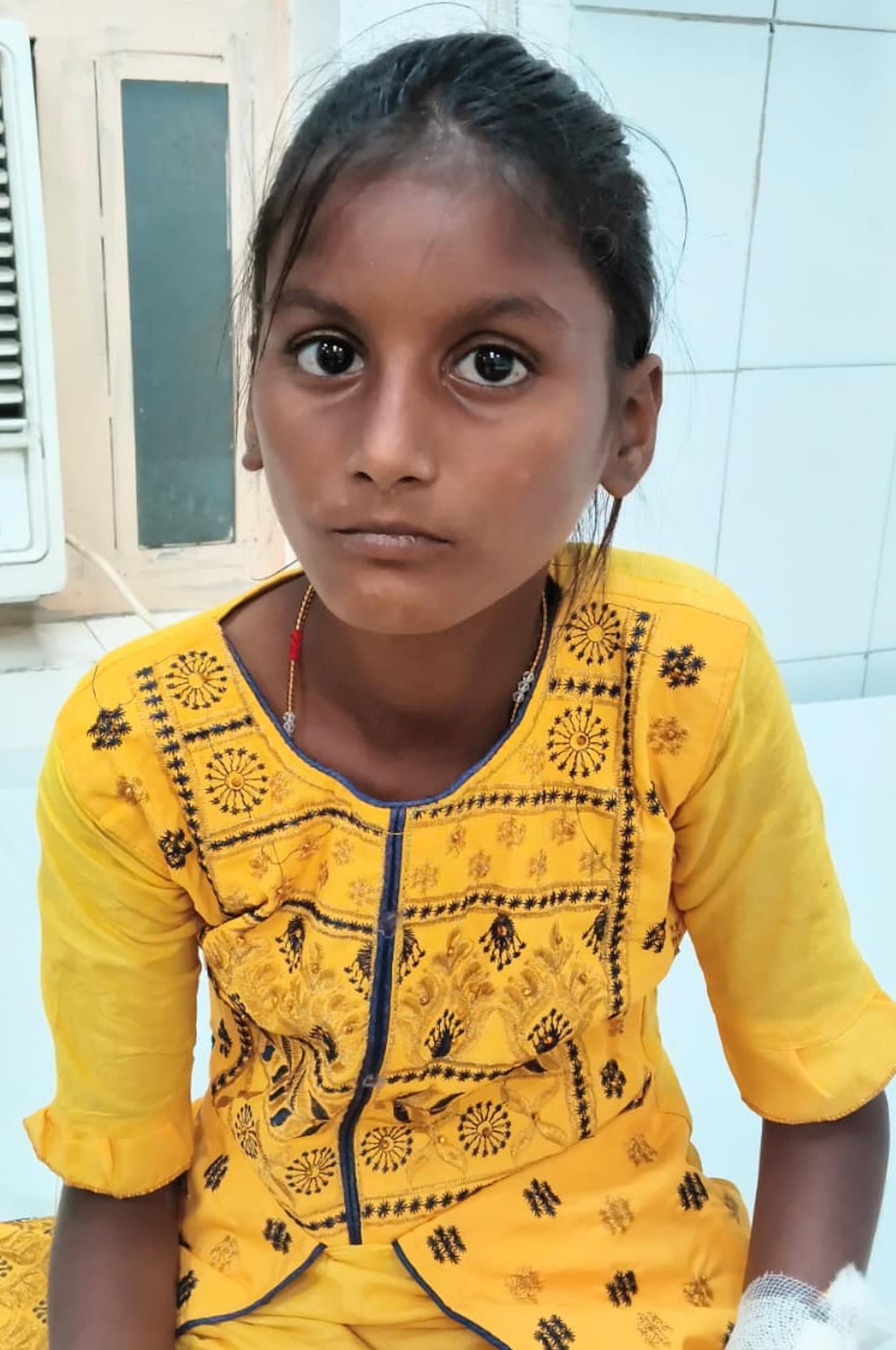 कुत्तों के हमलों में घायल मासूम। कुत्तों के हमलों में घायल मासूम।