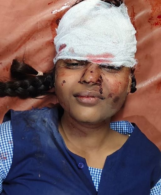 घायल प्रिया मौर्या घायल प्रिया मौर्या