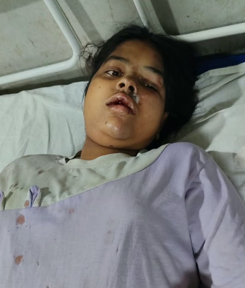 घायल प्रिया मौर्या घायल प्रिया मौर्या