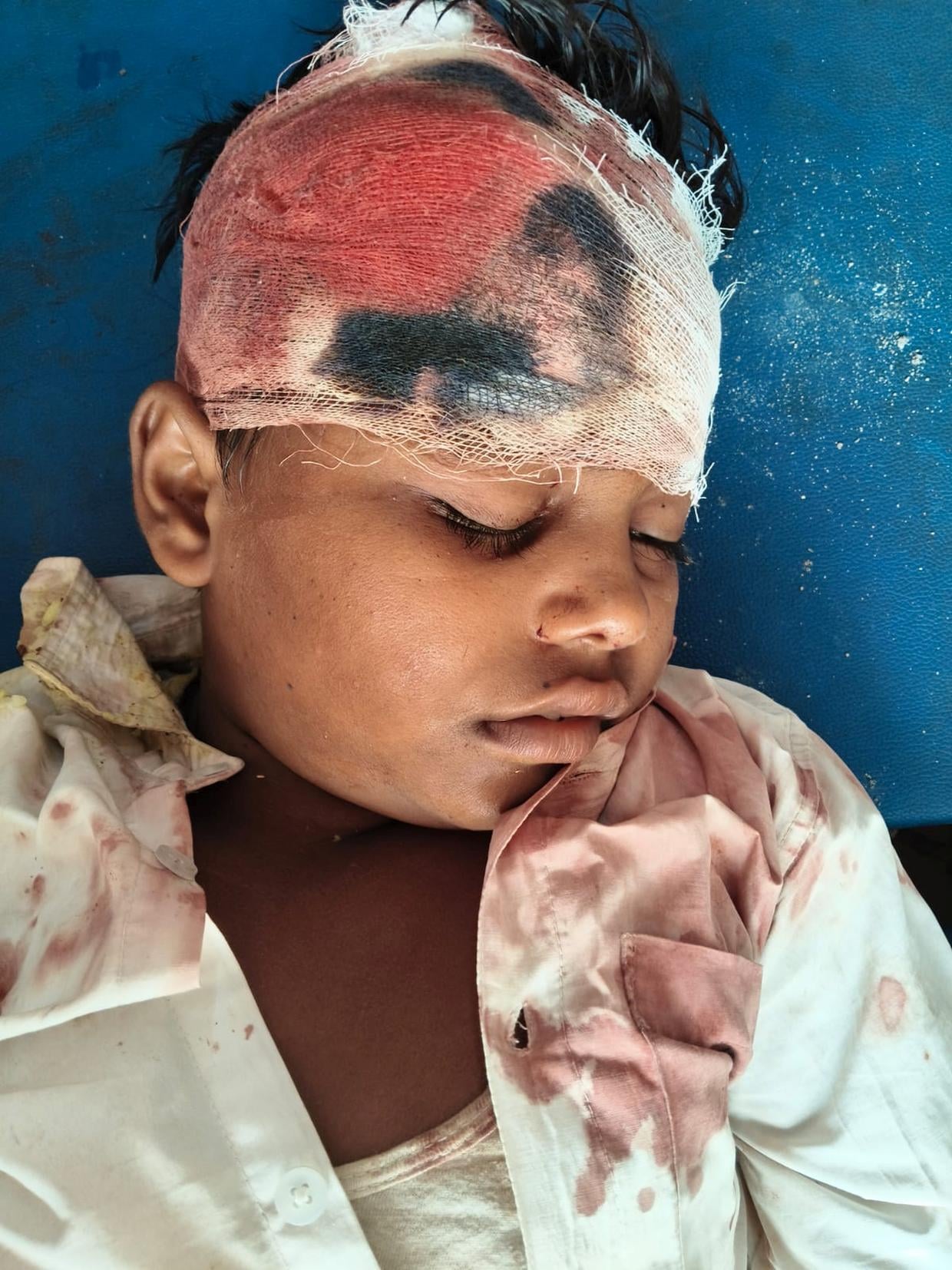 हादसे में घायल छात्र व दुर्घटना के बाद खड़ी बस। हादसे में घायल छात्र व दुर्घटना के बाद खड़ी बस।