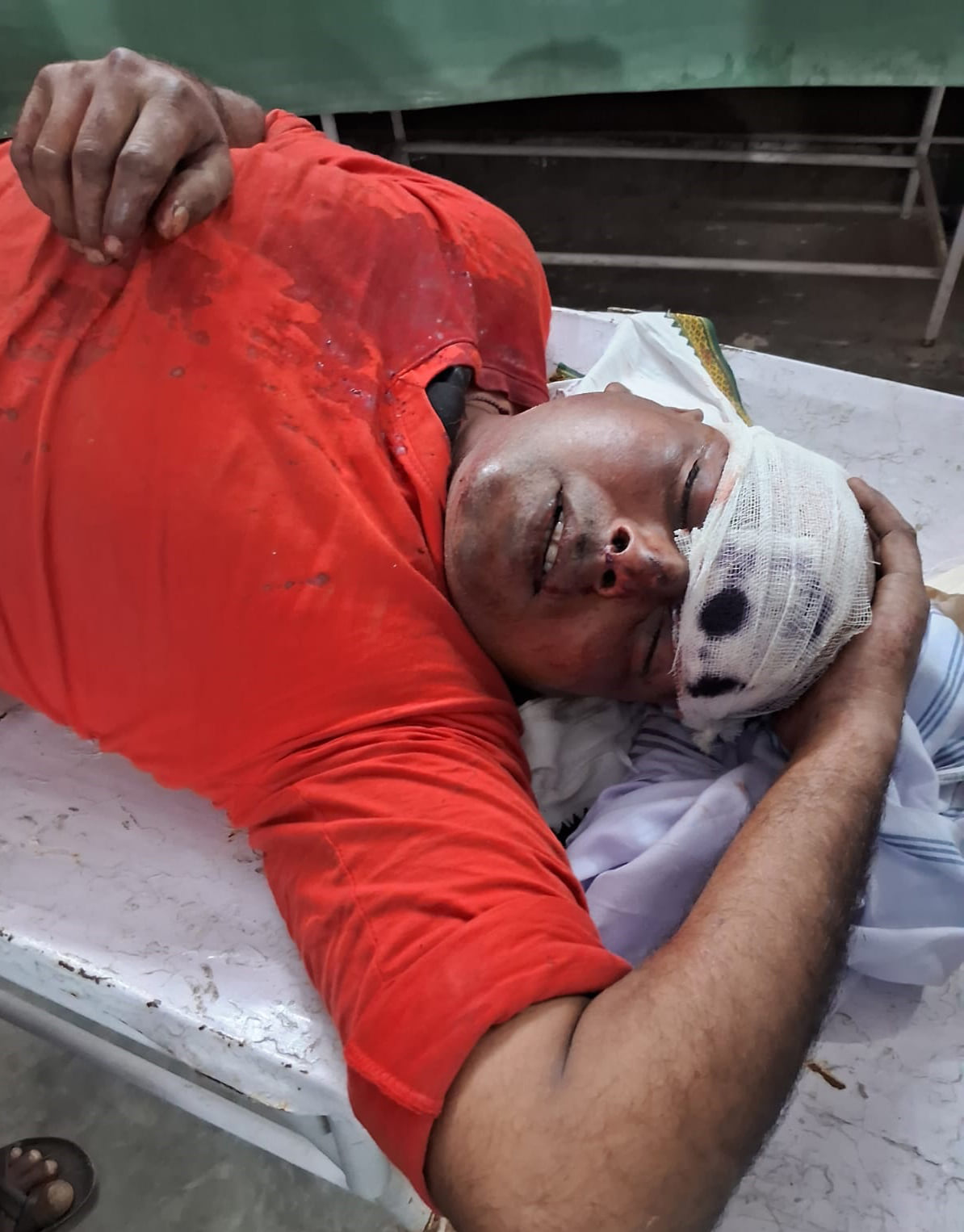 घायल चमेली देवी। संवाद