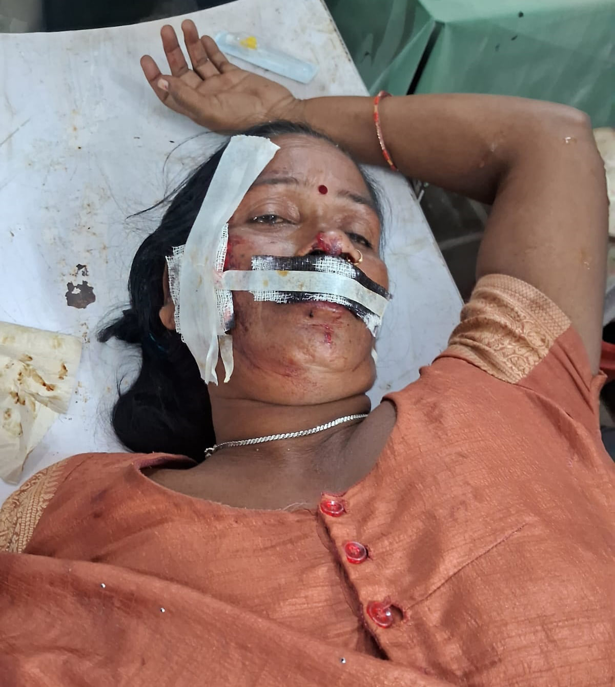 घायल चमेली देवी। संवाद