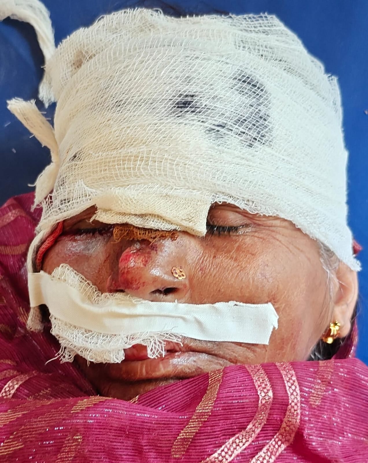 फोटो - 10 हादसे के बाद सीएचसी में भर्ती घायल। संवाद