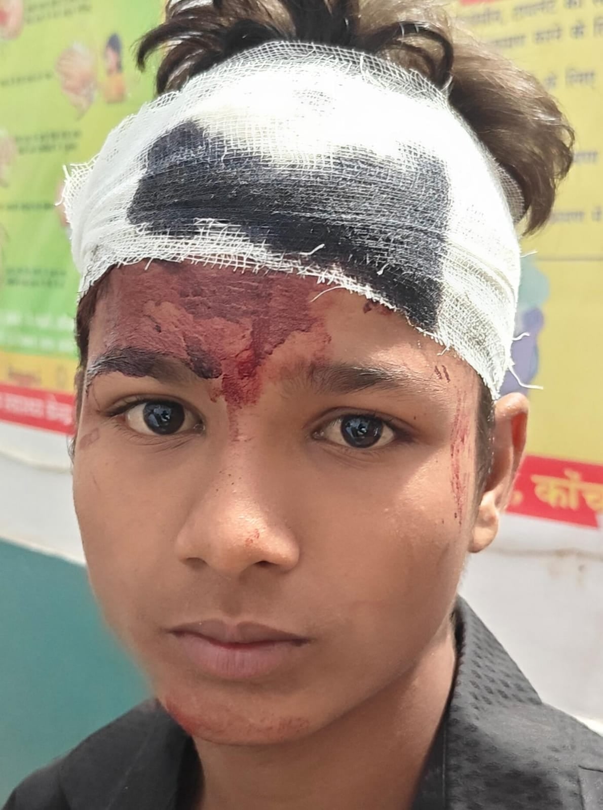 फोटो - 02 मारपीट में घायल दीपू। संवाद फोटो - 02 मारपीट में घायल दीपू। संवाद