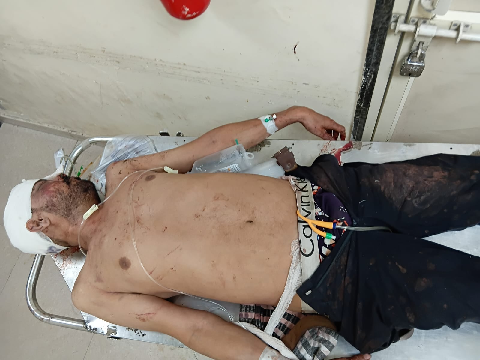 फोटो 58 घायल कार चालक जगदीश। संवाद