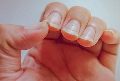 Astrological Special 2022- Know Shape Of Your Fingernail And What It Says About Your Personality- My Jyotish Astrological Special 2022- Know Shape Of Your Fingernail And What It Says About Your Personality- My Jyotish