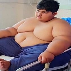 pakistani child weight 200kg in 10 years