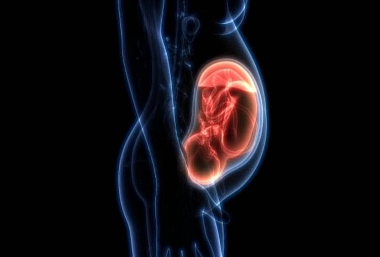 35 year old stone baby fetus found in woman stomach after pain doctors shocked