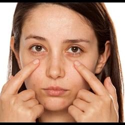 dark circles home remedies in hindi How To Remove Under Eye Dark Circles Naturally