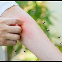 Machchar bhagane ke gharelu Upaye how to make mosquito repellent at home in hindi