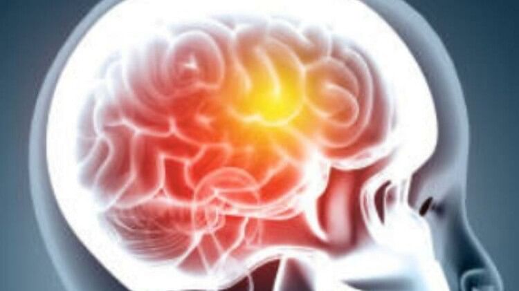 brain